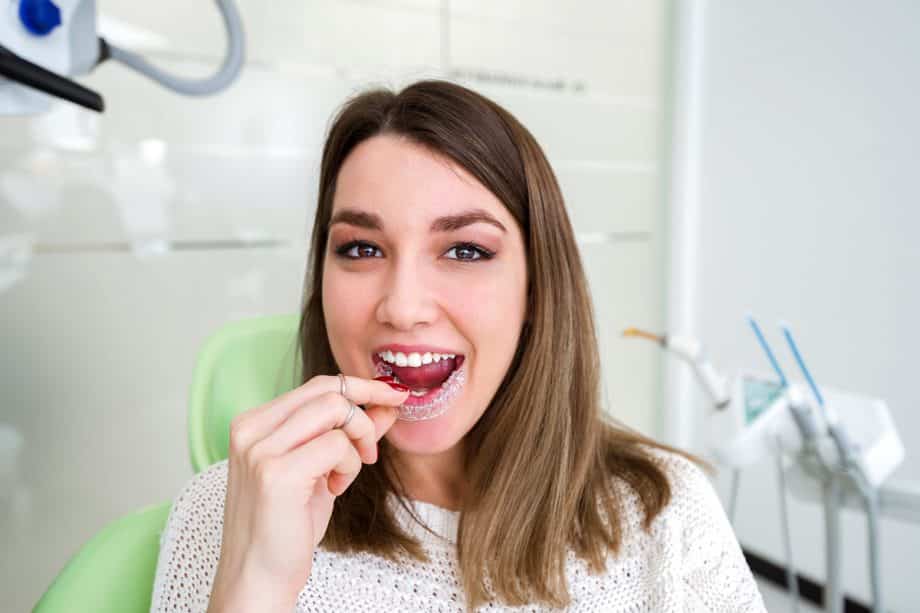 Benefits of Invisalign