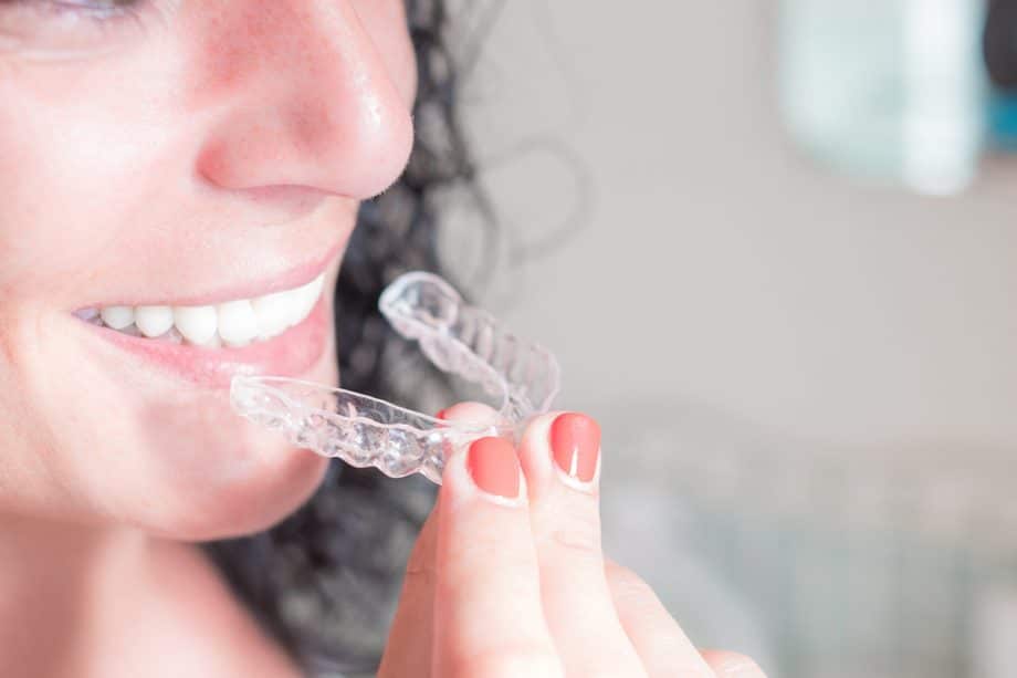 https://www.nowakfamilydental.com/wp-content/uploads/how-do-you-clean-invisalign-retainers-trays-920x613.jpg